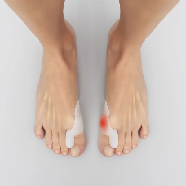 Corrector Protector de Silicona para Juanetes Bunilief InnovaGoods 2 Unidades