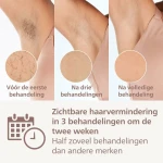 Depiladora Eléctrica de Luz Pulsada Philips BRI946/00     *