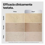 Depiladora Eléctrica Braun