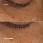 Sérum Iluminador Clinique ALL ABOUT EYES 10 ml