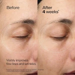 Protector Labial Shiseido FUTURE SOLUTION LX